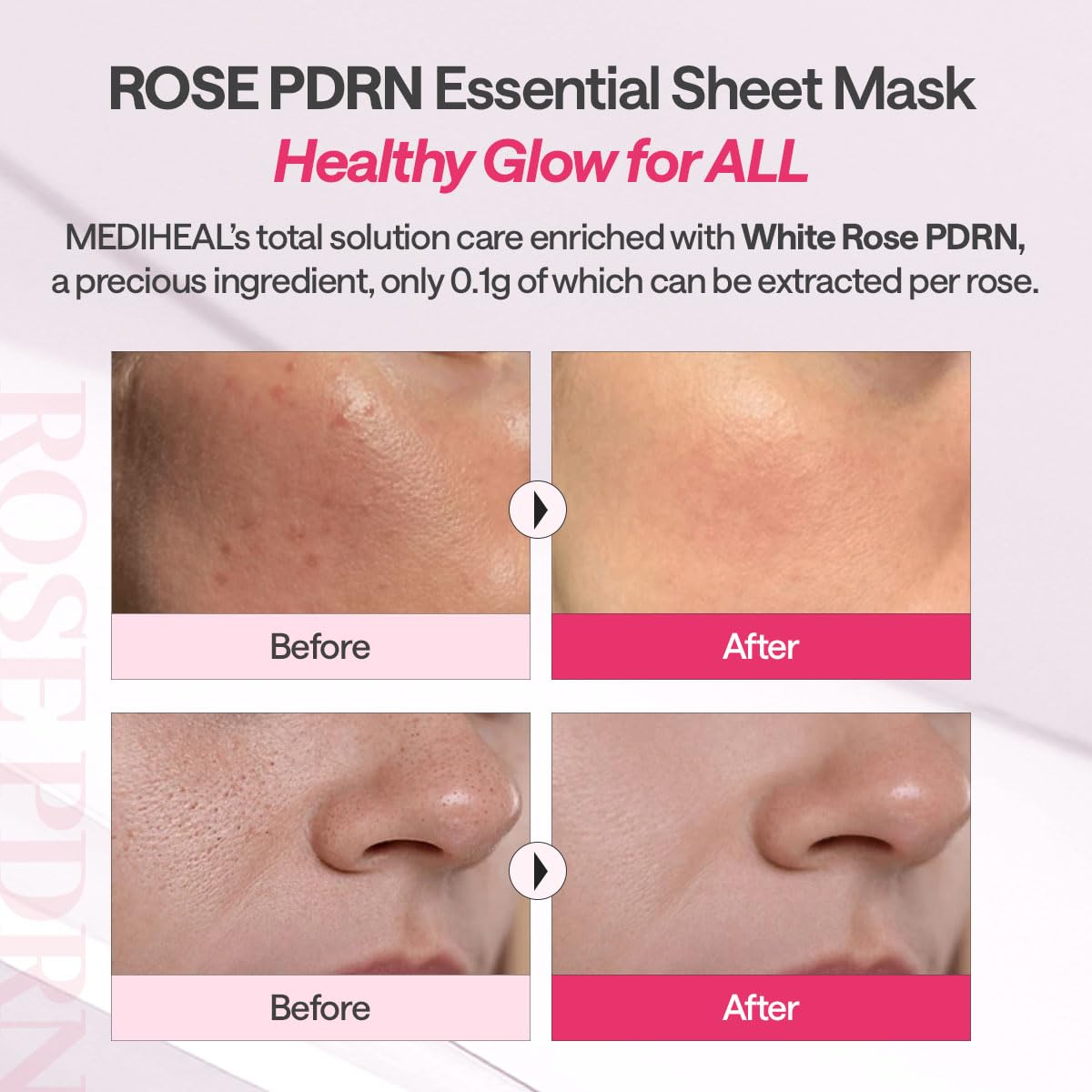 MEDIHEAL Rose PDRN Essential Face Sheet Mask ingredients list