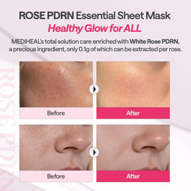 MEDIHEAL Rose PDRN Essential Face Sheet Mask ingredients list