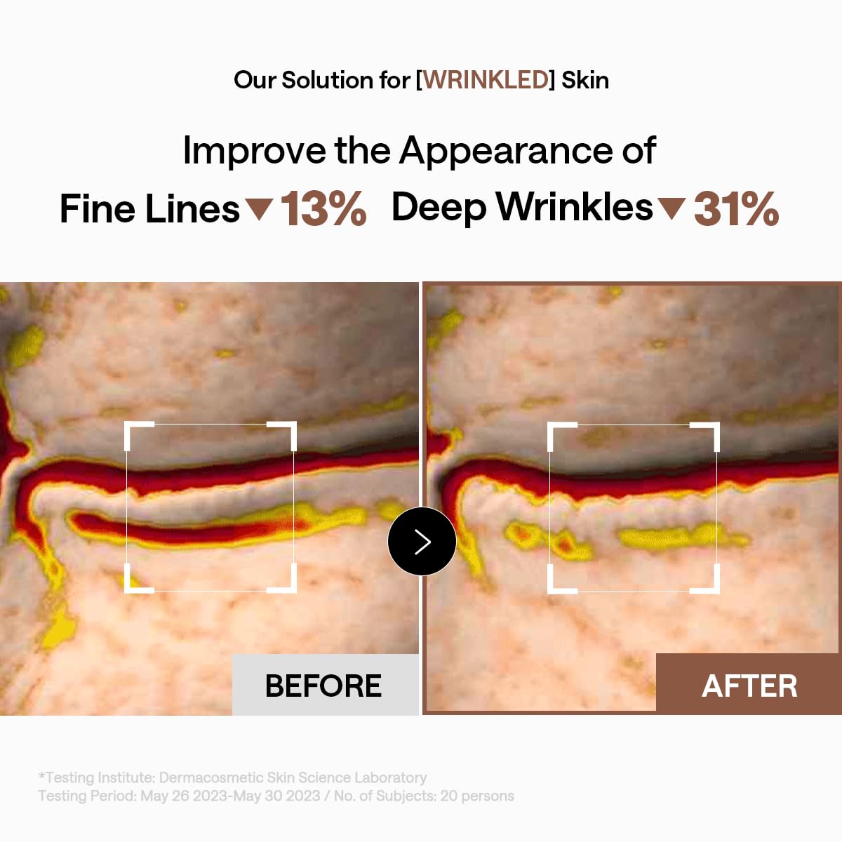 MEDIHEAL Under Eye Patches showing texture