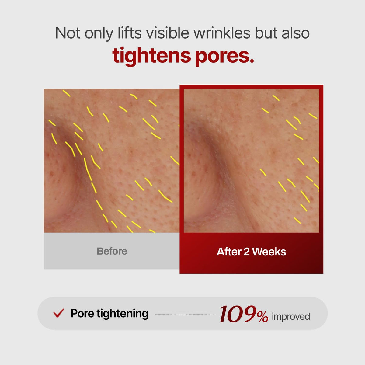 MEDITHERAPY Wrinkle-fit Mask ingredients list