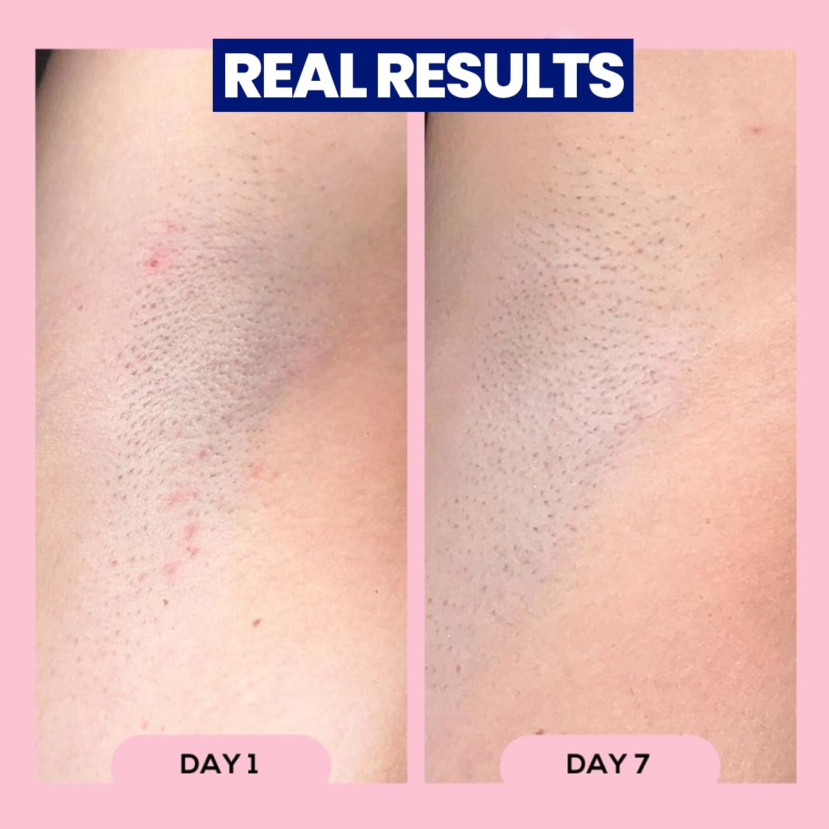 Megababe Après Shave Roll-On lifestyle shot