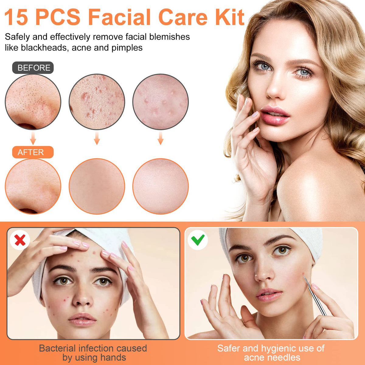 Metal case for IUMAKEVP blackhead remover tool kit