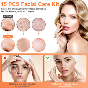 Metal case for IUMAKEVP blackhead remover tool kit