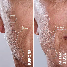 MICHAEL TODD Sonicsmooth Dermaplane Razor packaging