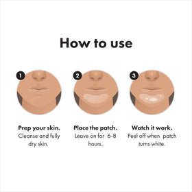 Mighty Patch Chin Acne Pimple Patch back view