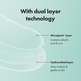 Mighty Patch Micropoint XL Acne Pimple Patches on a skin surface
