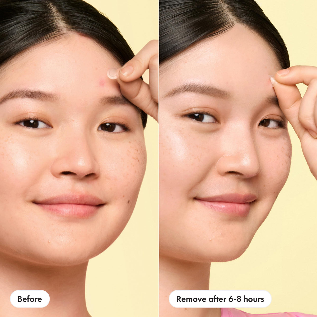 Mighty Patch Mini Invisible+ Acne Pimple Patch lifestyle scene