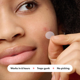 Mighty Patch Original Pimple Patch showing translucent matte finish