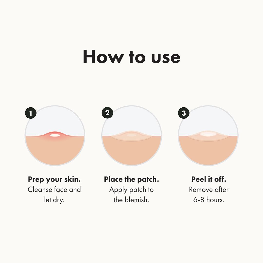 Mighty Patch Original Pimple Patches in a lifestyle setting