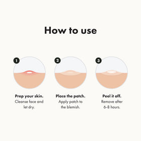 Mighty Patch Original Pimple Patches in a lifestyle setting