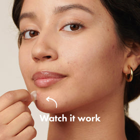 Mighty Patch Original Pimple Patches on easy-peel perforated sheets