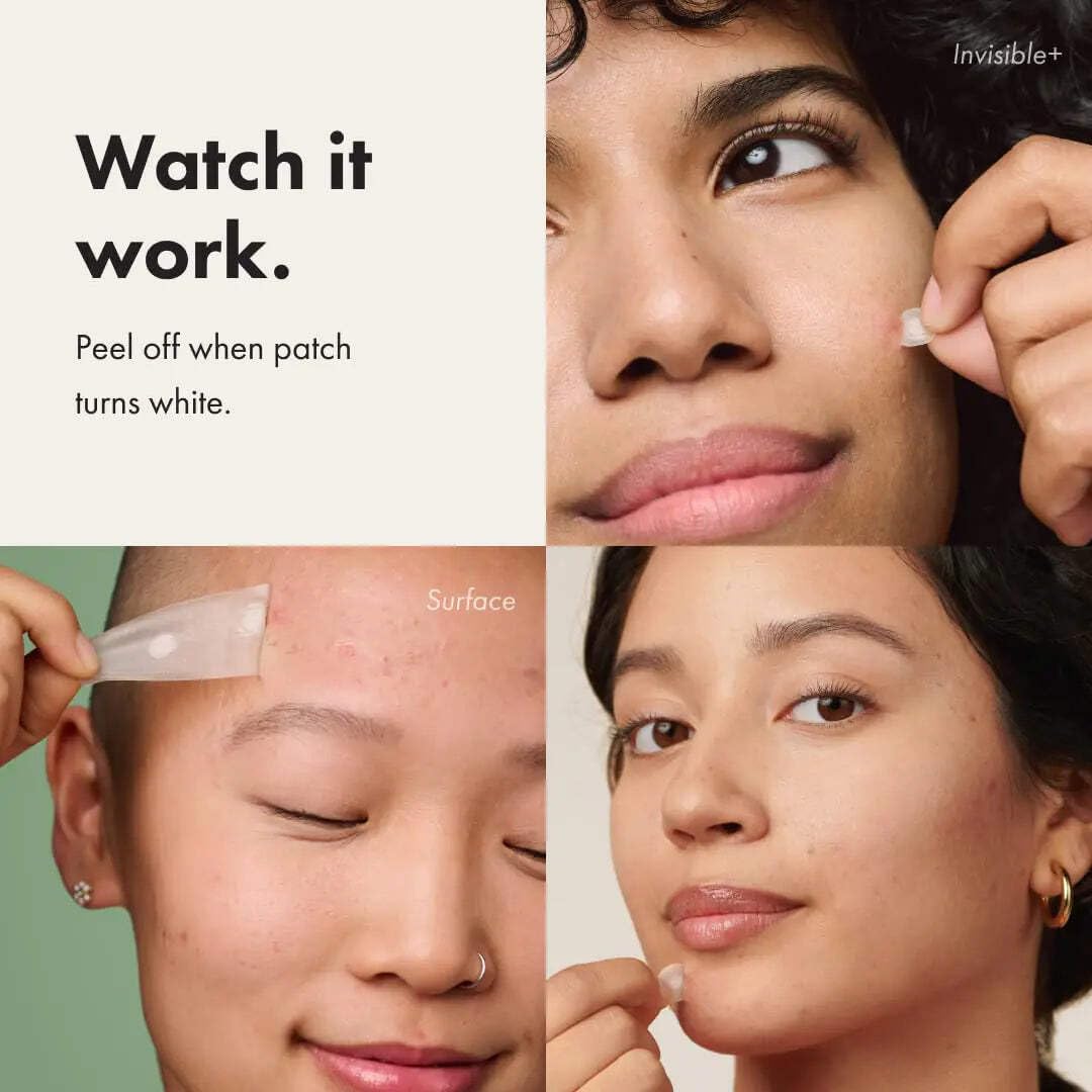 Mighty Patch patches applied on a pimple
