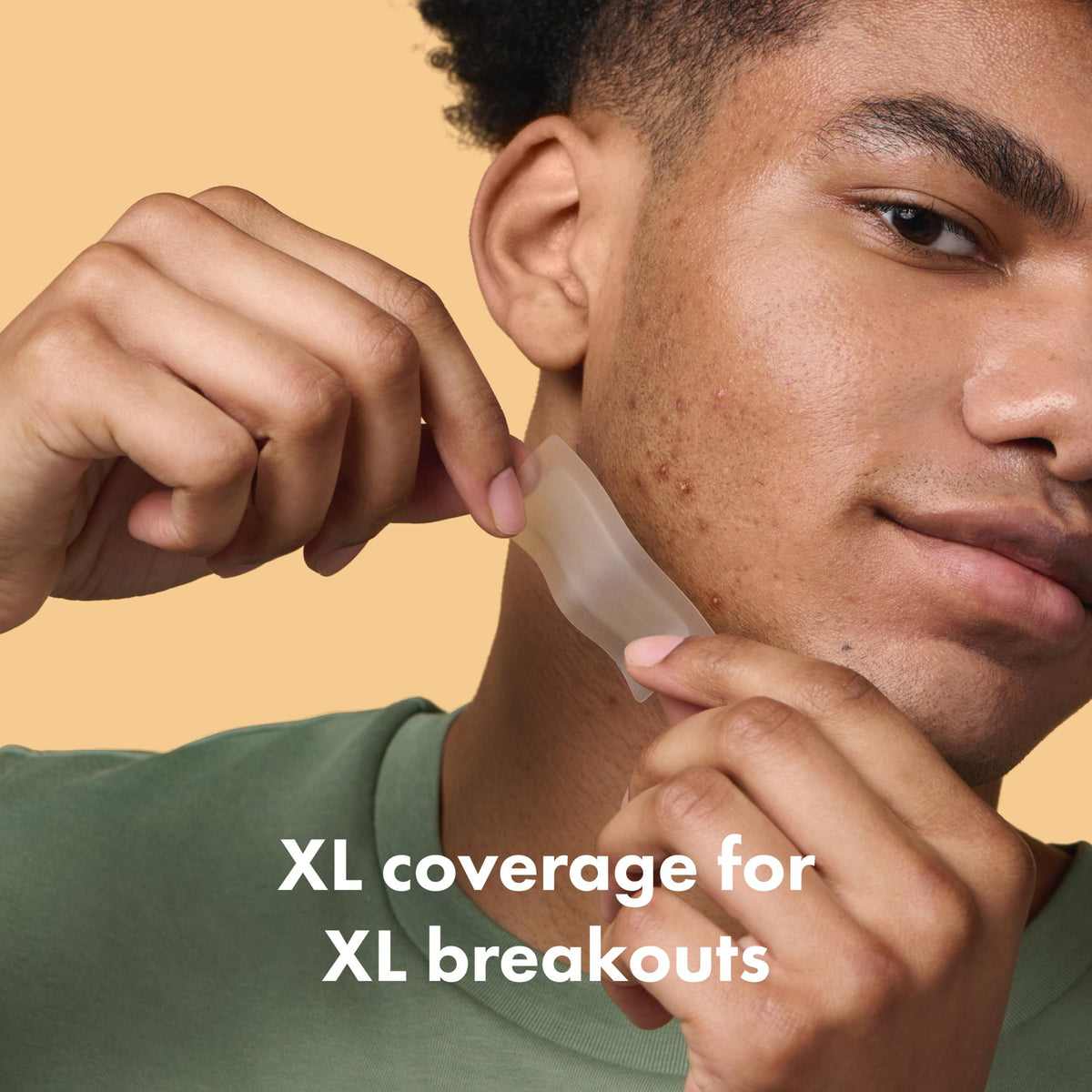 Mighty Patch Surface packaging with 10 acne patches