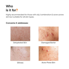 Minimalist Panthenol Face Moisturizer 10% texture close-up