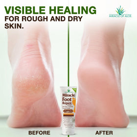 Miracle Foot Repair Cream 4 oz product label
