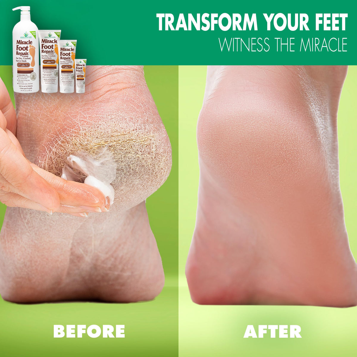 Miracle of Aloe Foot Repair Cream 4 Oz with aloe vera details