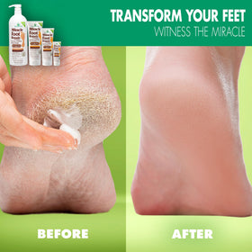 Miracle of Aloe Foot Repair Cream 4 Oz with aloe vera details