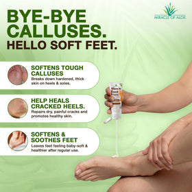 Miracle of Aloe Foot Repair Cream application on foot