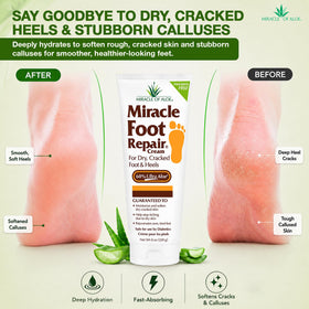 Miracle of Aloe UltraAloe Foot Cream texture close-up