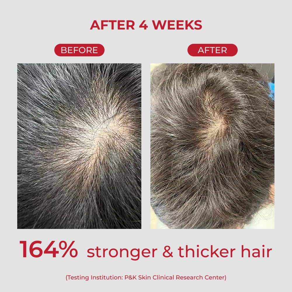 MOEV ANNURCATIN Shampoo lathering on hair