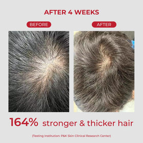 MOEV ANNURCATIN Shampoo lathering on hair