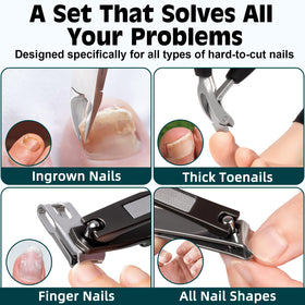 MPKDZNE toenail clippers made from surgical steel