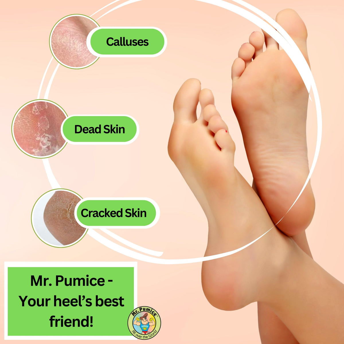 Mr. Pumice Callus Remover Pumi Bar in hand for demonstration