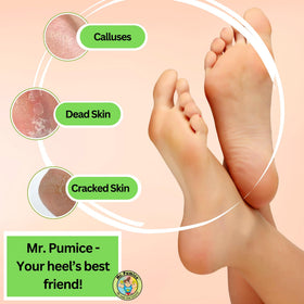 Mr. Pumice Callus Remover Pumi Bar in hand for demonstration