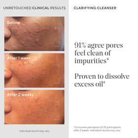 Murad Acne Control Clarifying Cleanser application on hand