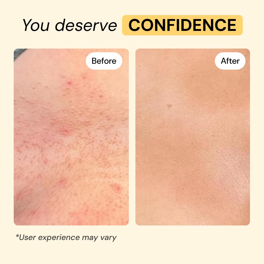MyMagicHealer Universal Flare Care 1 oz texture close-up