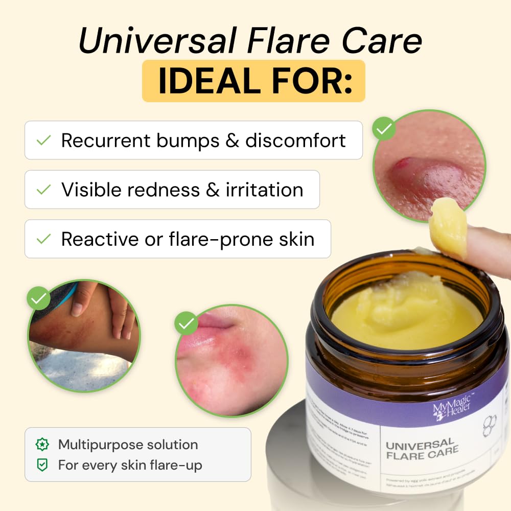 MyMagicHealer Universal Flare Care 2 oz packaging