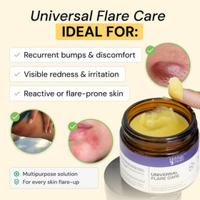 MyMagicHealer Universal Flare Care 2 oz packaging
