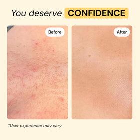 MyMagicHealer Universal Flare Care 2 oz side view