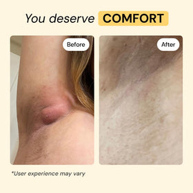 MyMagicHealer Universal Flare Care packaging