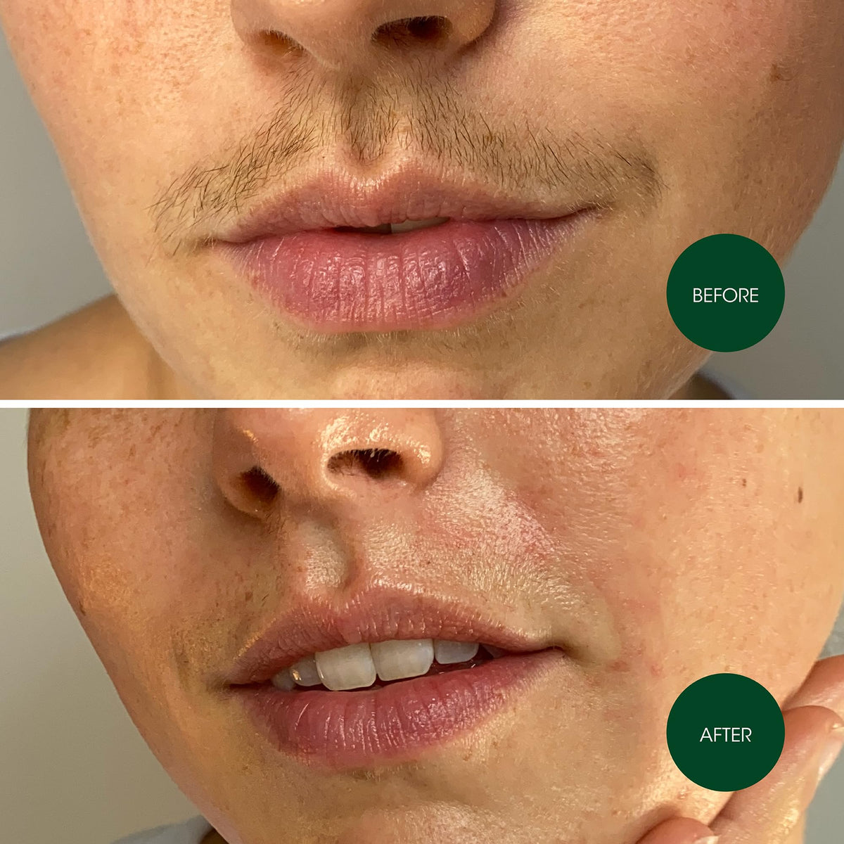 Nad's Facial Wax Strips in use on upper lip