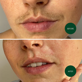 Nad's Facial Wax Strips in use on upper lip