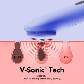 NågraCoola Facial Cleansing Brush side view showing silicone bristles