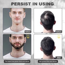 Naland beard balm being applied to facial hair