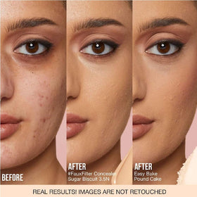 NAPH H.U.D.A BEAUTY Mini Easy Bake Loose Powder with acne patches