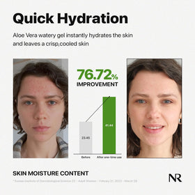 Nature Republic Aloe Vera Gel applied on skin