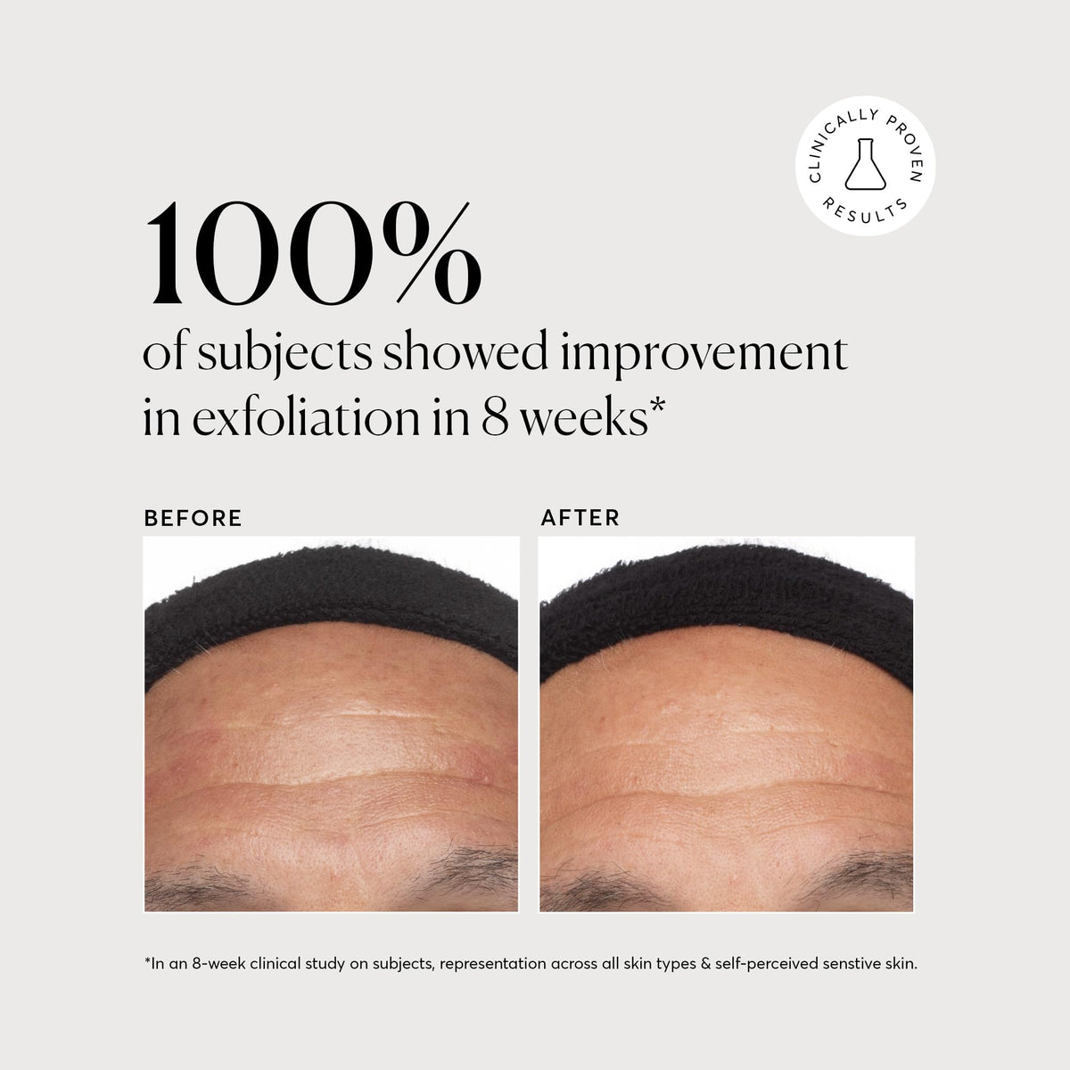 Naturium Azelaic Acid Serum back view with ingredient list