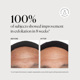 Naturium Azelaic Acid Serum back view with ingredient list