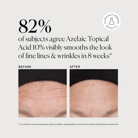 Naturium Azelaic Acid Serum lifestyle scene on bathroom counter