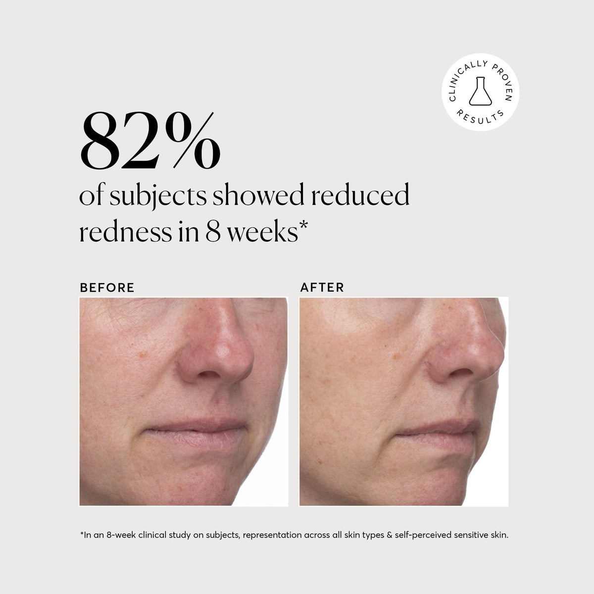 Naturium Azelaic Acid Serum with other skincare products