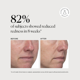 Naturium Azelaic Acid Serum with other skincare products