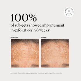 Naturium BHA Liquid Exfoliant 2% ingredients list