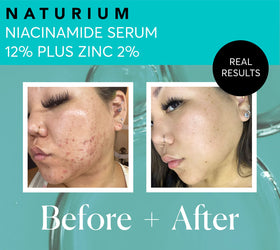 Naturium Niacinamide Serum 12% Plus Zinc 2% with drops
