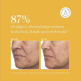 Naturium Tranexamic Topical Acid 5% Jumbo Serum texture on skin