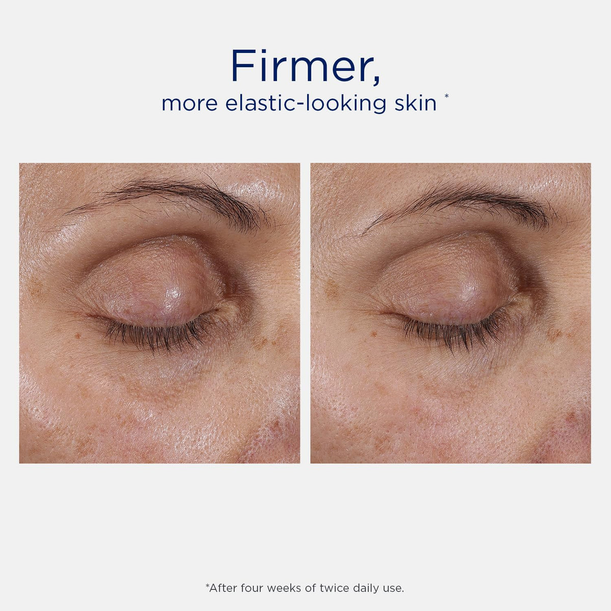 NEOSTRATA Intensive Eye Therapy application on skin