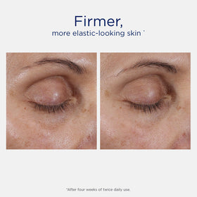 NEOSTRATA Intensive Eye Therapy application on skin